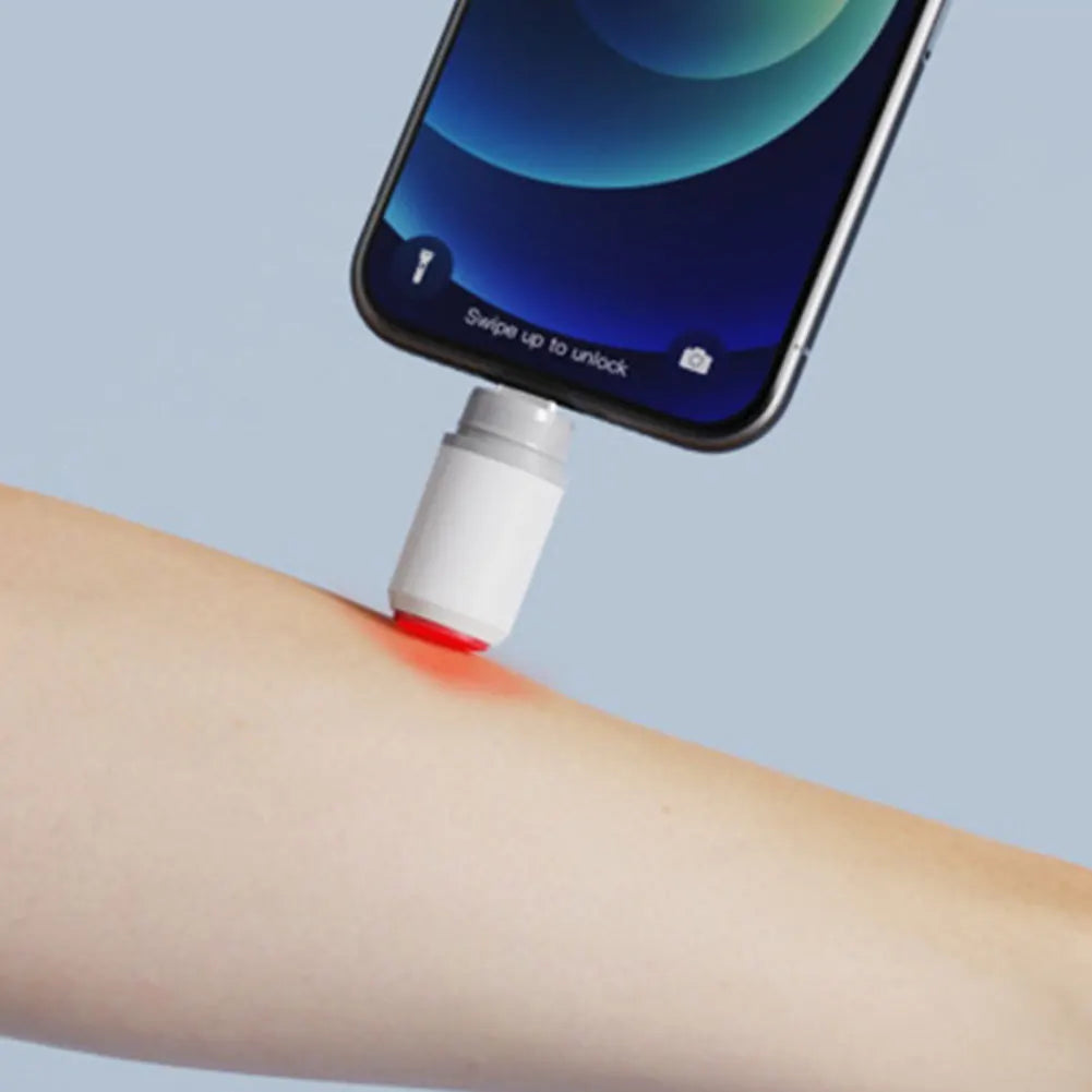 Bug Bite Heat Relief Pen – Chemical-Free Itch Soothing Device