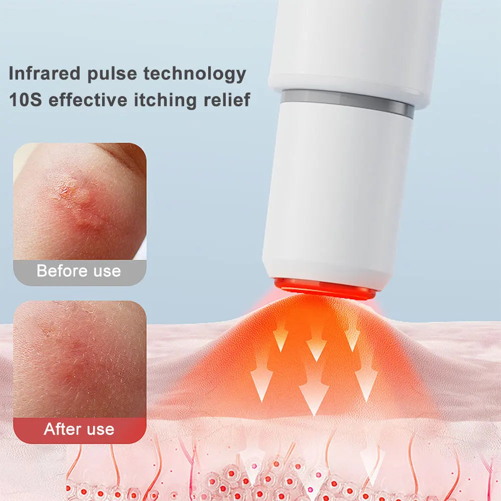 Bug Bite Heat Relief Pen – Chemical-Free Itch Soothing Device